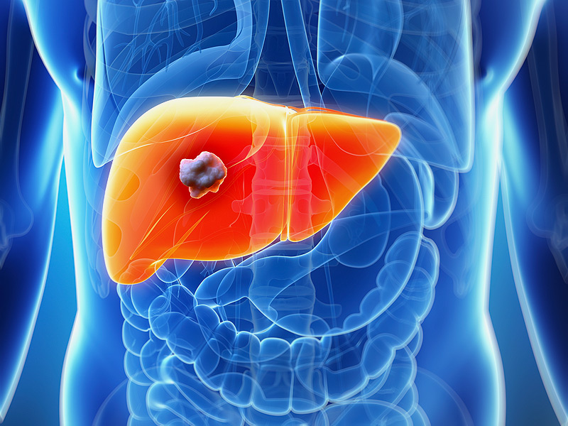saffronbasedcrocinmaypreventlivercancer